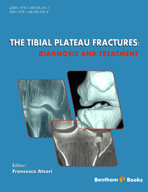 The Tibial Plateau Fractures: Diagnosis and Treatment
