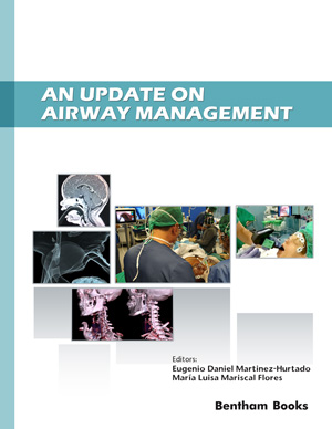 An Update on Airway Management