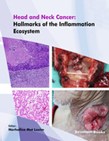 Head and Neck Cancer: Hallmarks of The Inflammation Ecosystem