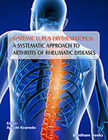 .Systemic Lupus Erythematosus: A Systematic Approach to Arthritis of Rheumatic Diseases.