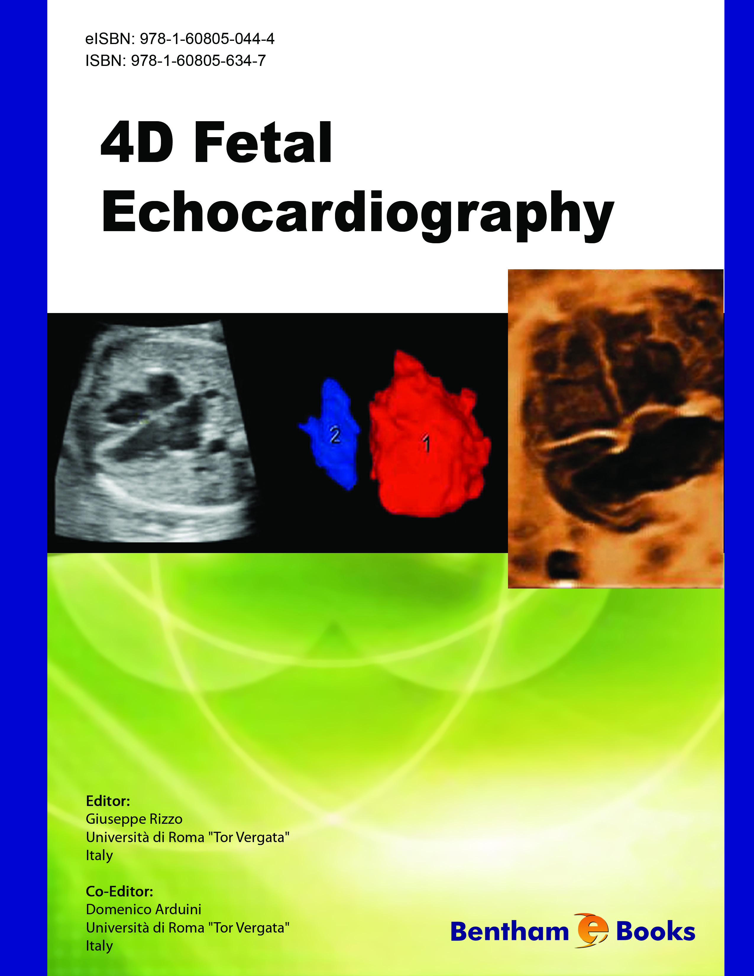 4D Fetal Echocardiography