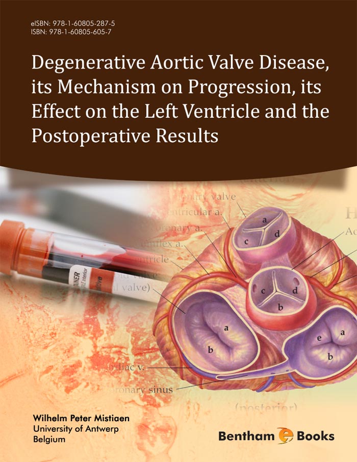 Degenerative Aortic Valve Disease, its Mechanism on Progression, its Effect on the Left Ventricle and the Postoperative Results