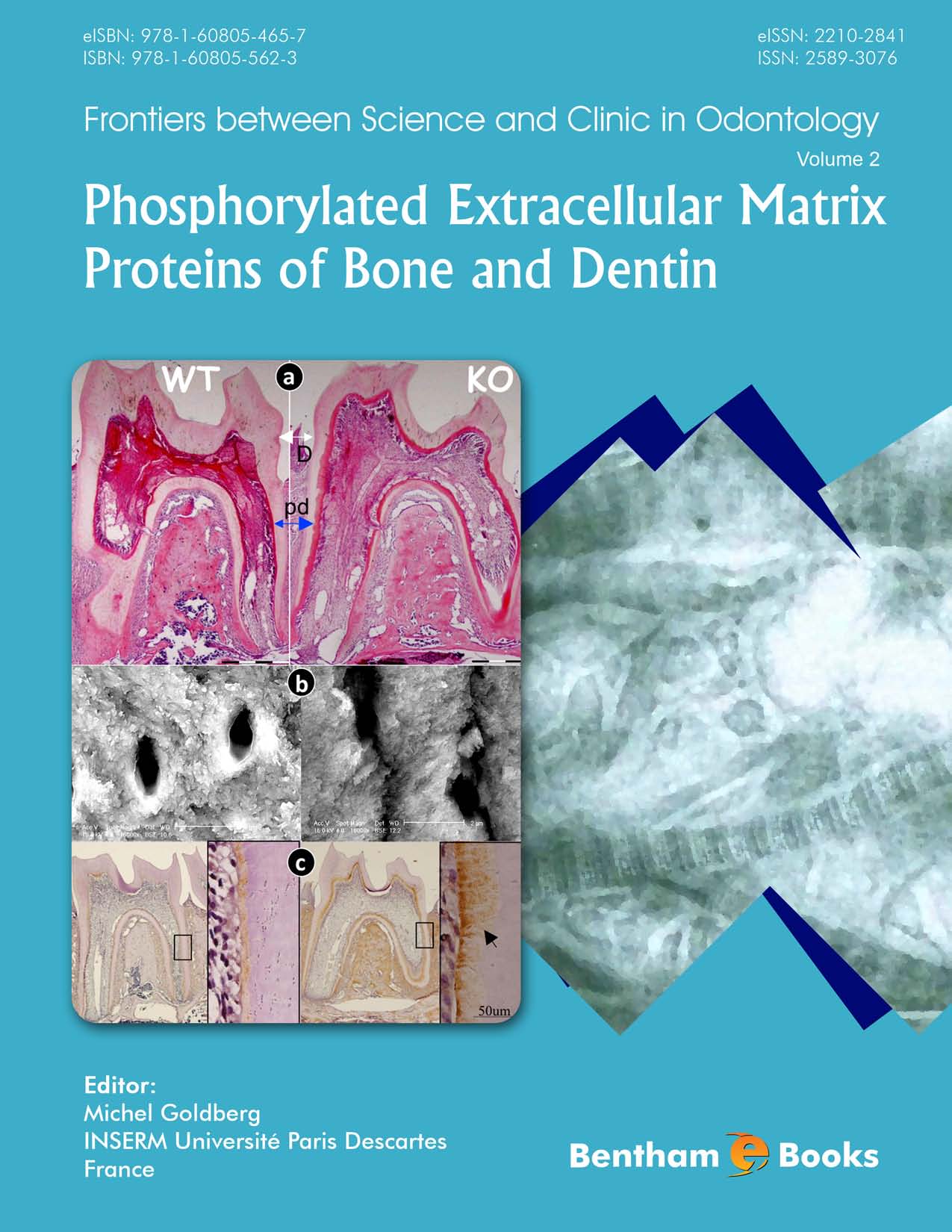 Phosphorylated Extracellular Matrix Proteins of Bone and Dentin