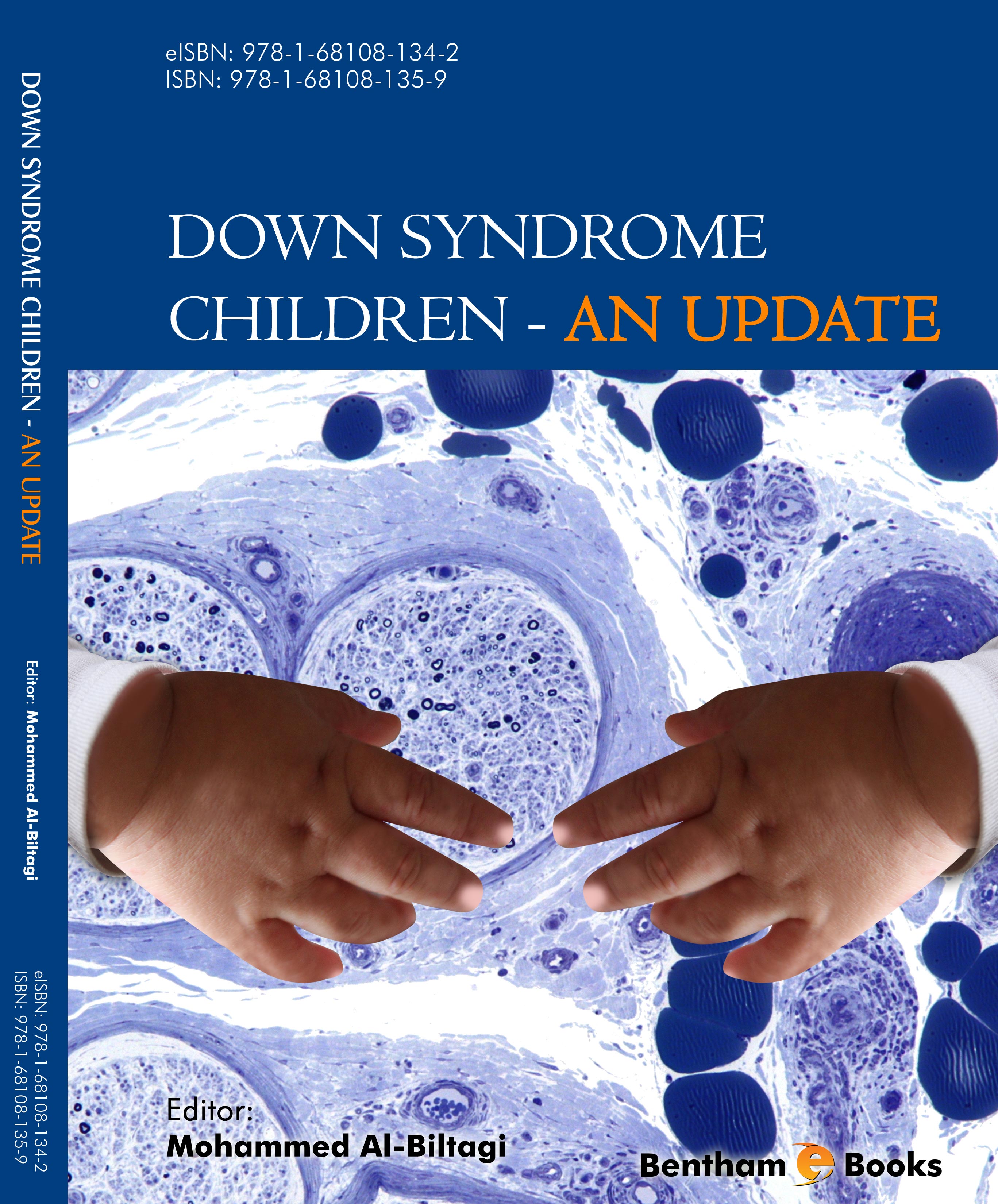 Down Syndrome Children - An Update