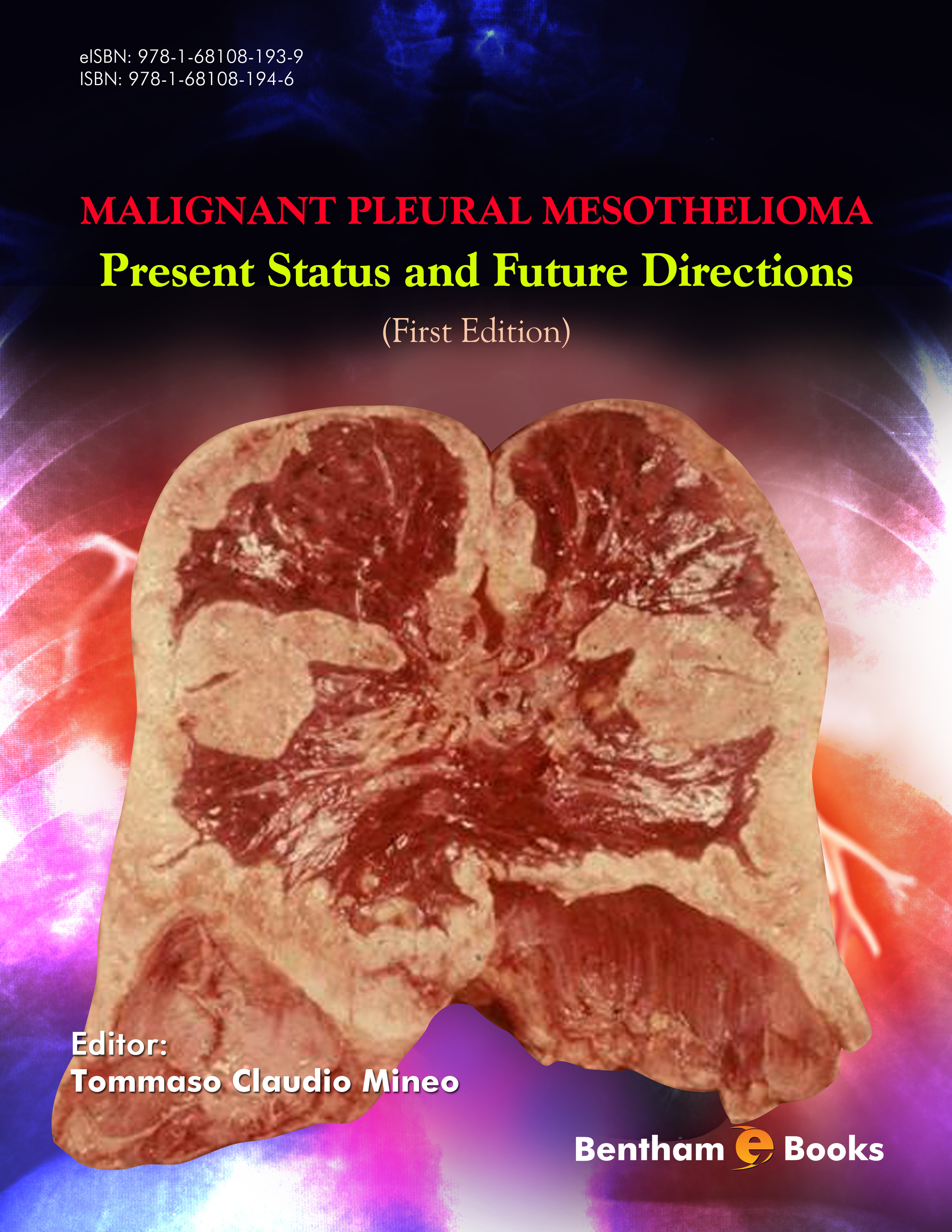 Malignant Pleural Mesothelioma: Present Status and Future Directions