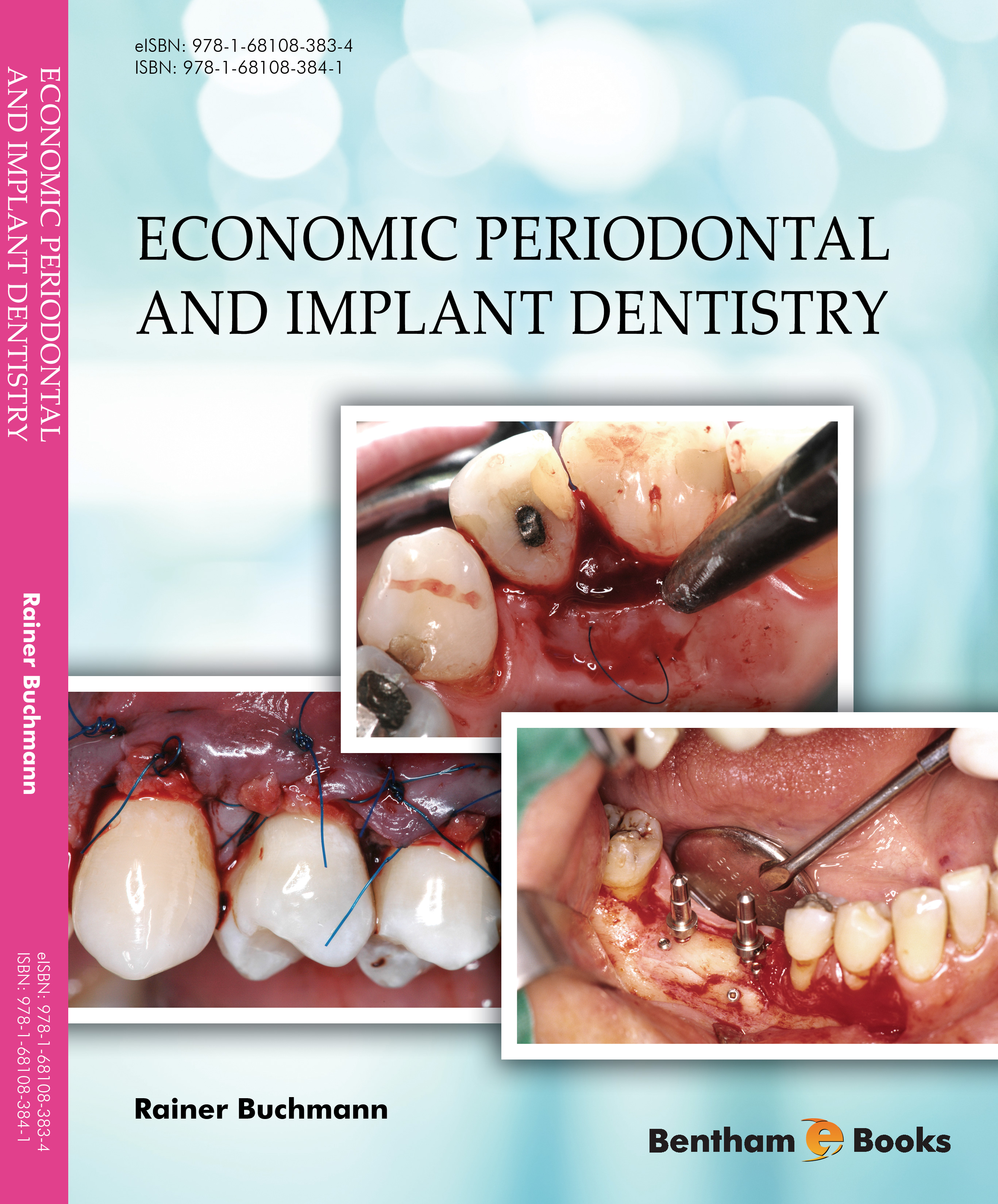 Economic Periodontal and Implant Dentistry