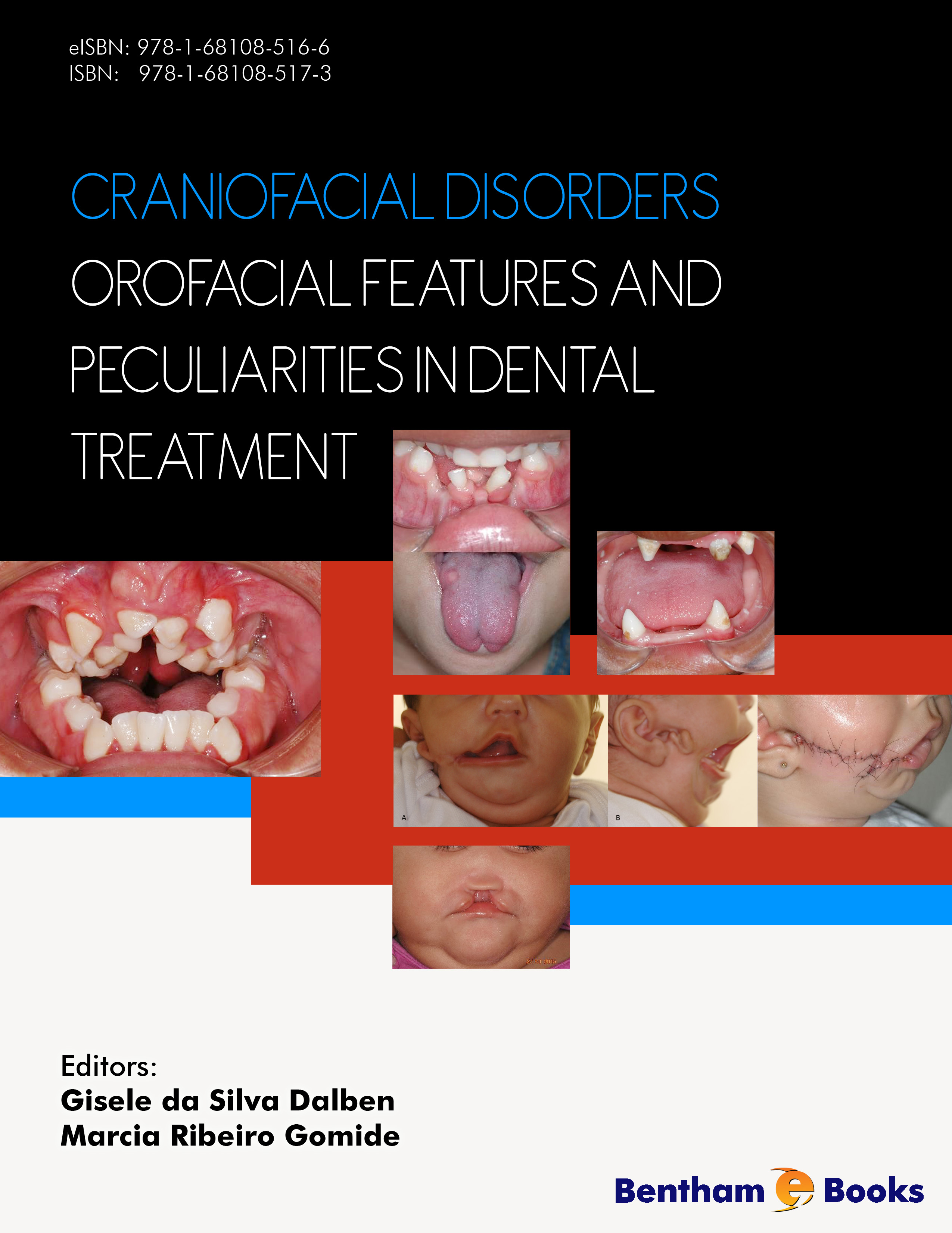 Craniofacial Disorders – Orofacial Features and Peculiarities in Dental Treatment