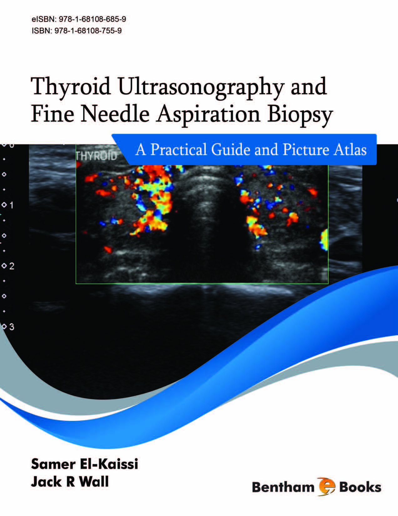 Thyroid Ultrasonography and Fine Needle Aspiration Biopsy: A Practical Guide and Picture Atlas