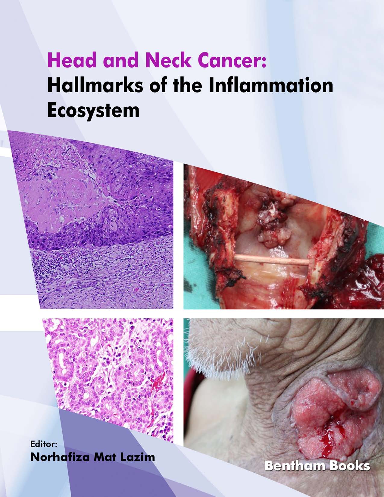 Head and Neck Cancer: Hallmarks of The Inflammation Ecosystem