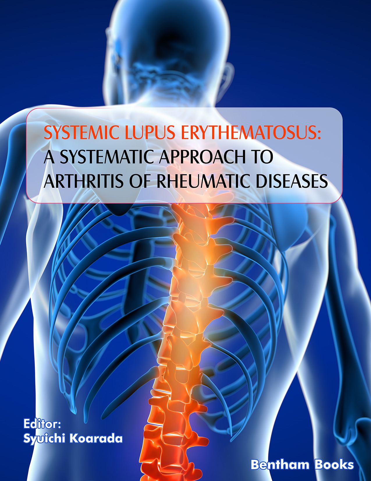 Systemic Lupus Erythematosus: A Systematic Approach to Arthritis of Rheumatic Diseases