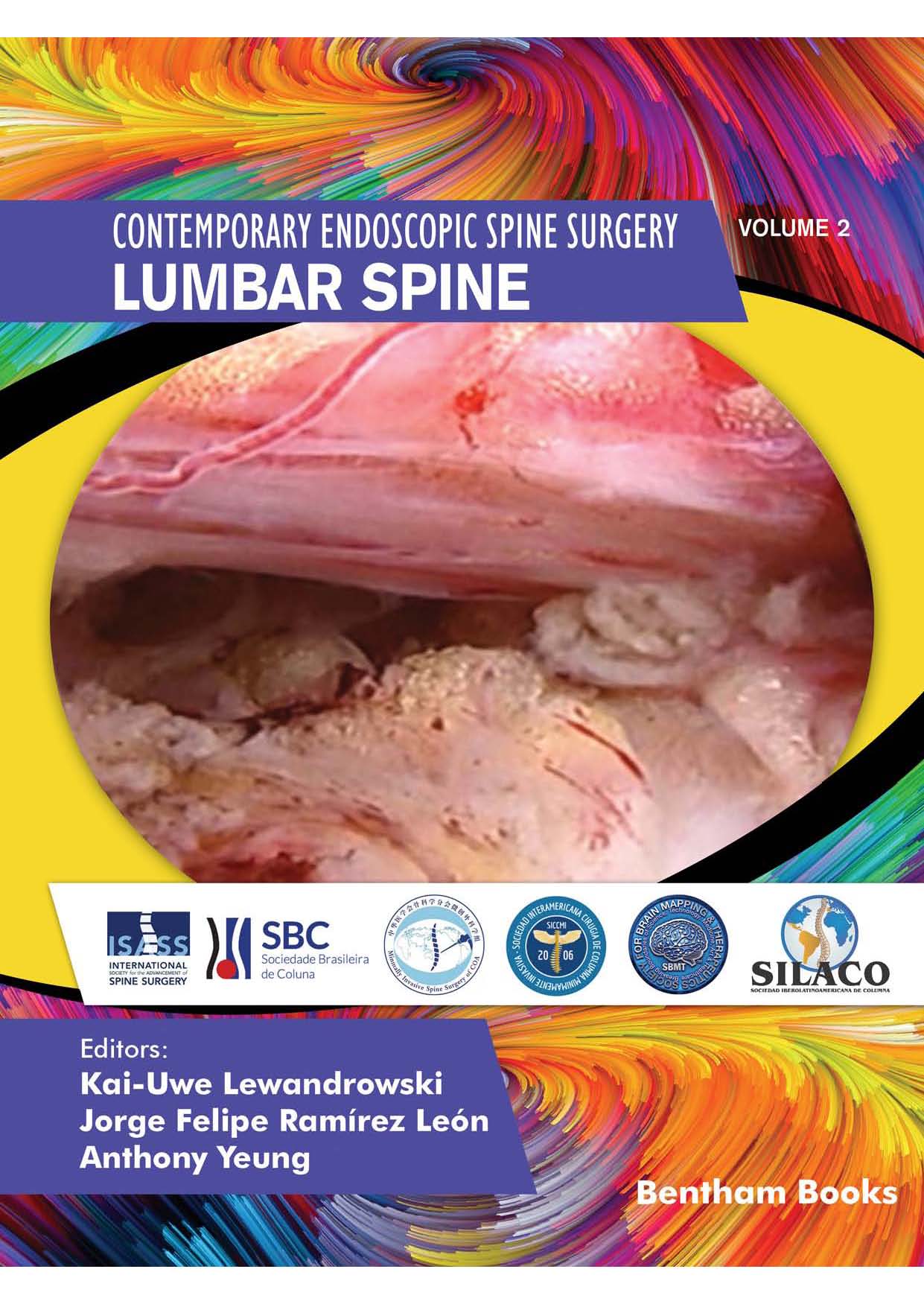 Contemporary Endoscopic Spine Surgery - Lumbar Spine