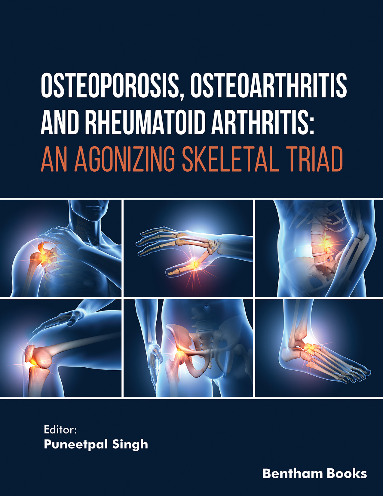 Osteoporosis, Osteoarthritis and Rheumatoid Arthritis: An Agonizing Skeletal Triad