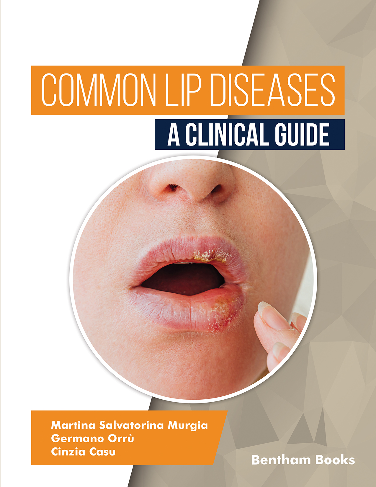 Common Lip Diseases: A Clinical Guide