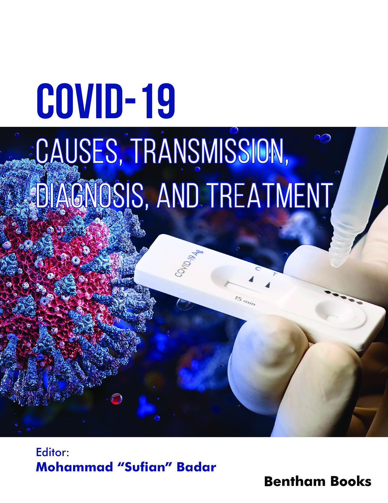 COVID-19: Causes, Transmission, Diagnosis, and Treatment