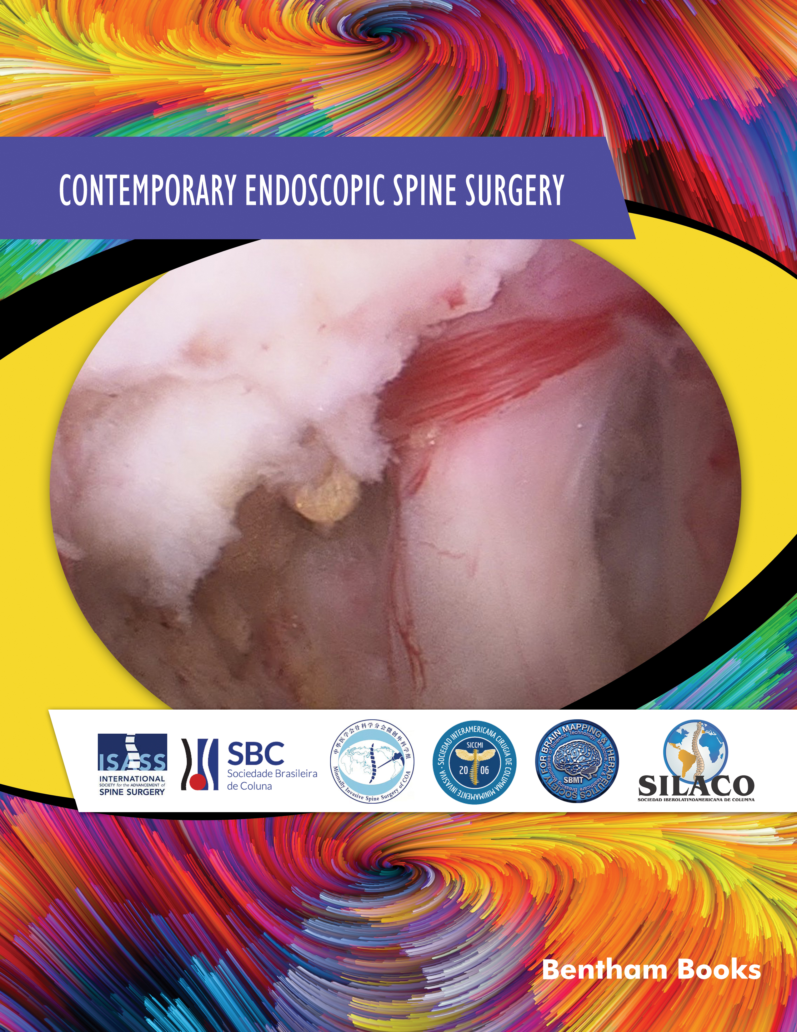 Contemporary Endoscopic Spine Surgery