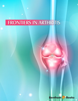 Frontiers in Arthritis